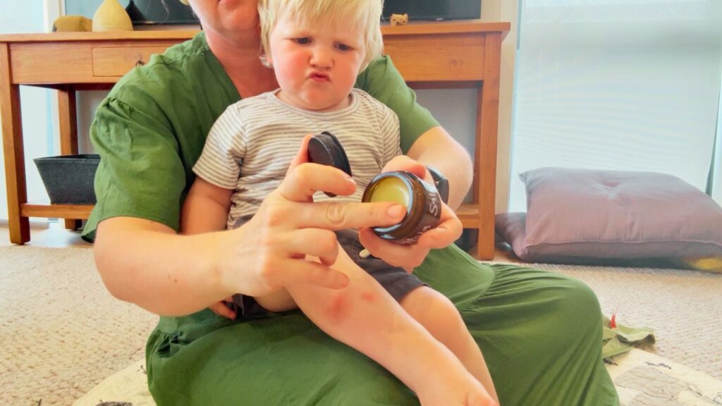 Mother and toddler sitting together, applying homemade plantain salve to a bite or scrape — natural itch relief at home.